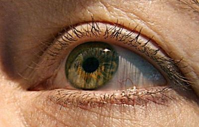 Alphabet-owned company aims to prevent eye disease